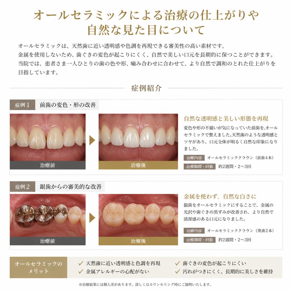 4. オールセラミックの仕上がり